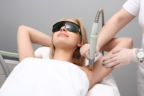 Laser hair removal - a new experience
